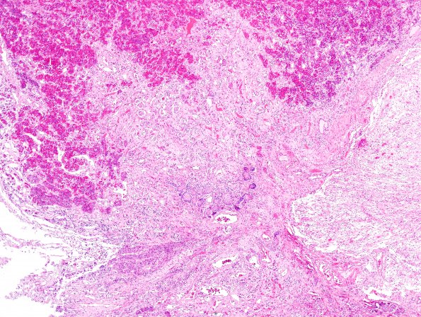 4A1 Pituitary, normal Hering Bodies and Erdheim rests (Case 4) H&E 5