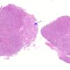 1A1 Herring bodies, neurohypophysis (Case 5) H&E 1