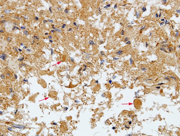 5 Herring bodies Synaptophysin