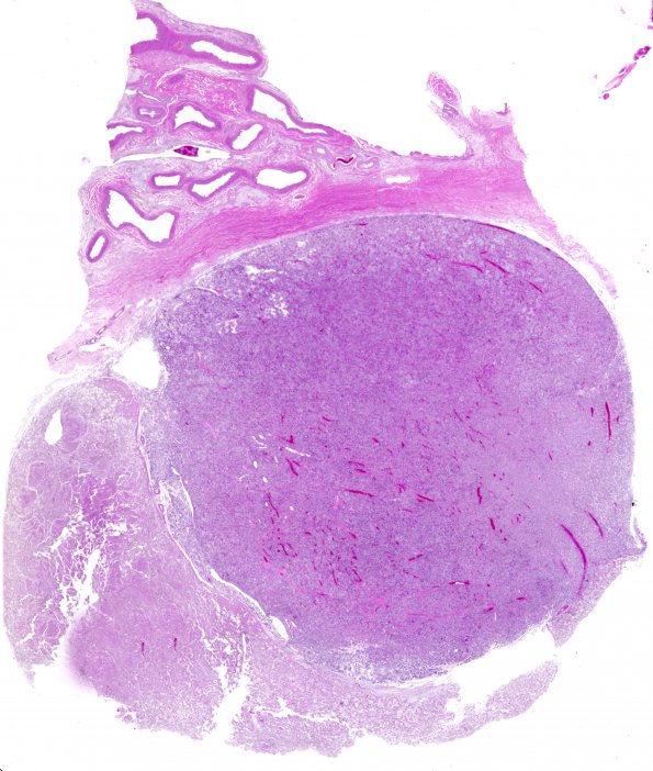 6A1 Herring bodies, neurohypophysis, Rhinoceros (ZOO) H&E 1