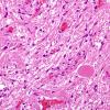 8A3 Pituitary, normal Hering bodies (Case 8) H&E 3