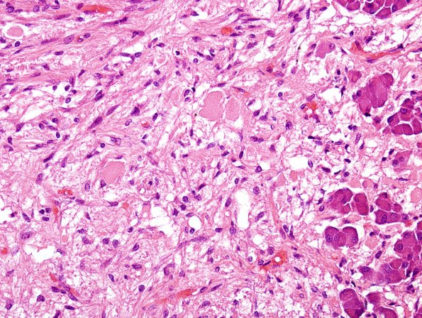 8A4 Pituitary, normal Hering bodies (Case 8) H&E 5