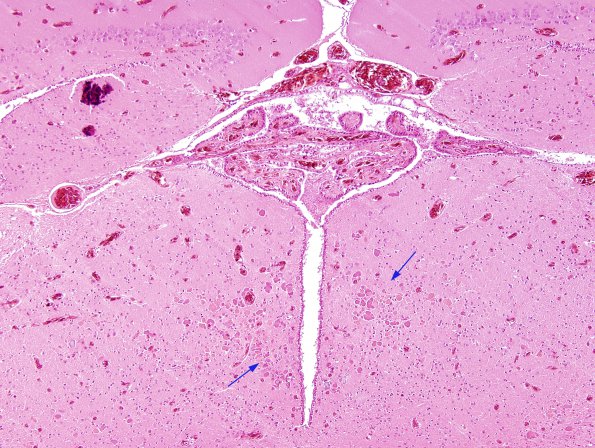 1A1 Inclusion, may be corpora amylacea, Viper, transcaucasian (ZOO) H&E 1