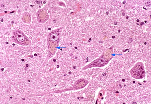 1 Lipofuscin, H&E