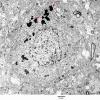 5A1 Lipofuscin, neuron (Case 3) EM 037 - CopyA