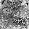 9 Macrophages EM (WUMS Case) - Copy