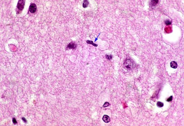 1 Microglia, resting, H&E 1