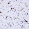 4A1 Microglia (Case 2) CD45 1