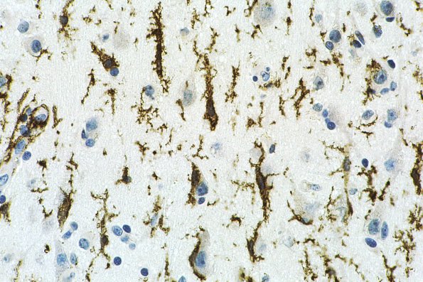 5 Microglia, rod cell CD68