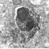 7A4 Neuronophagia, microglia West Nile Virus Iba-1 ImmunoEM 015