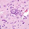 9A1 Microglial nodule vs neuronophagia, Virus 8