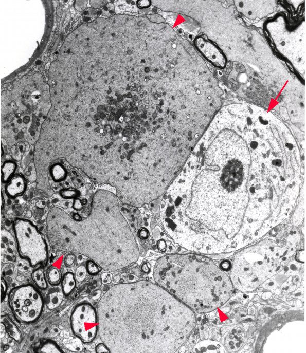 17 Diabetic Rat Gracile (BK30-243) DM10 EM 1 copy