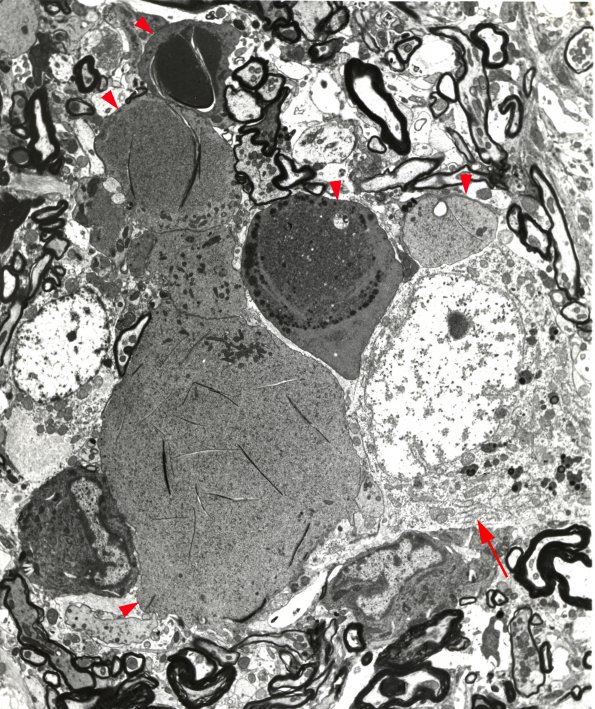 18B Aged Rat NAD, gracile (122-B2 age, 14 months EM 1A copy copy A