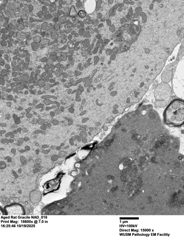 18C2 Aged Rat Gracile NAD_018 - Copy