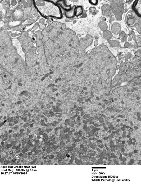 18C3 Aged Rat Gracile NAD_021 - Copy