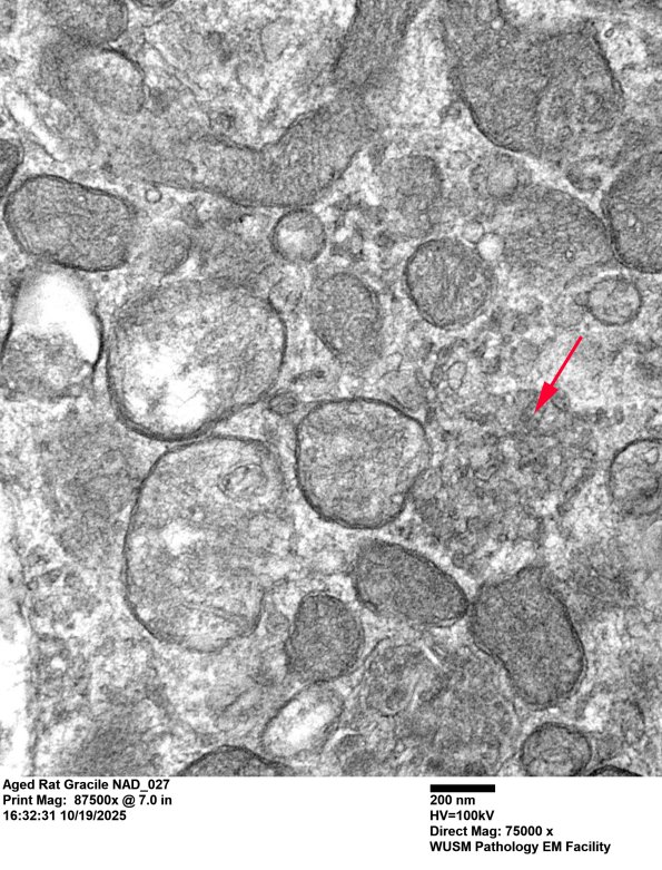 18C4 Aged Rat Gracile NAD_027 - Copy copy