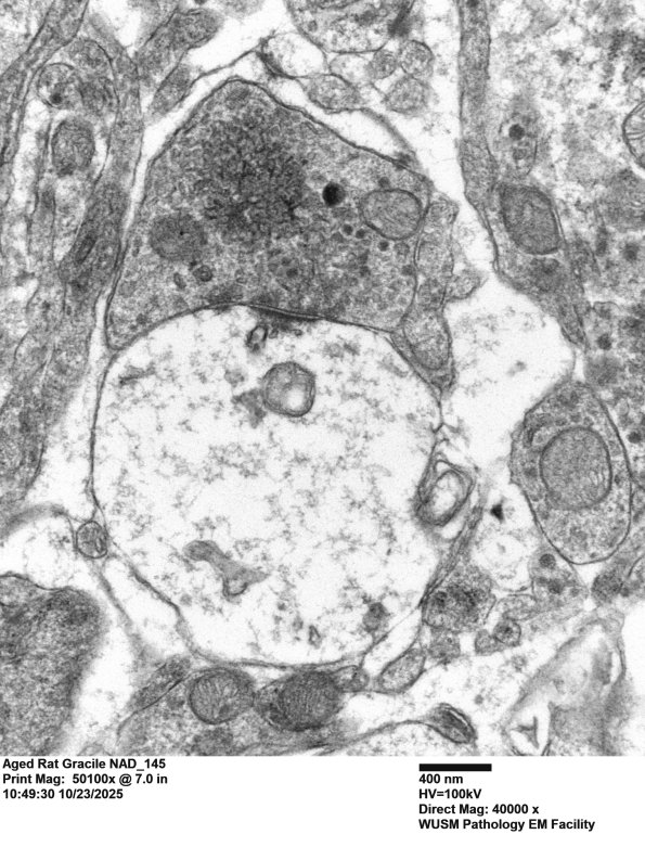 18N Aged Rat Gracile NAD_145 - Copy