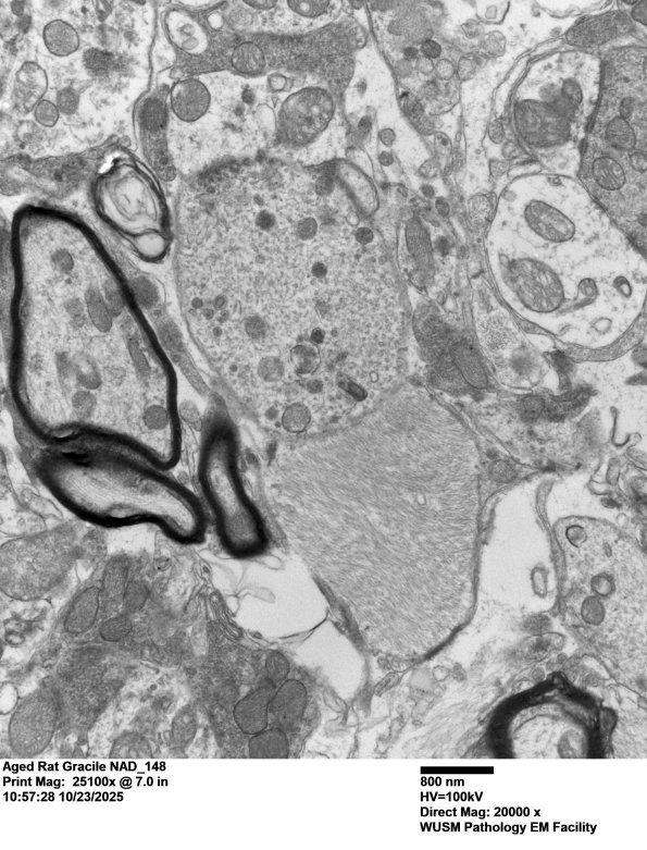 18O1 Aged Rat Gracile NAD_148 - Copy