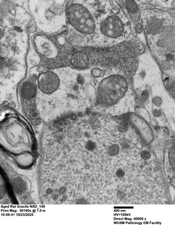 18O2 Aged Rat Gracile NAD_149 - Copy