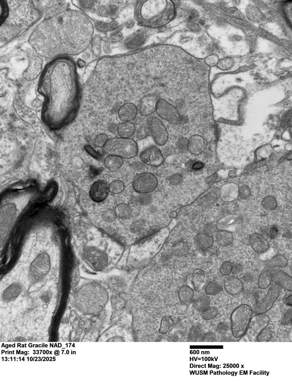18P1 Aged Rat Gracile NAD_174 - Copy