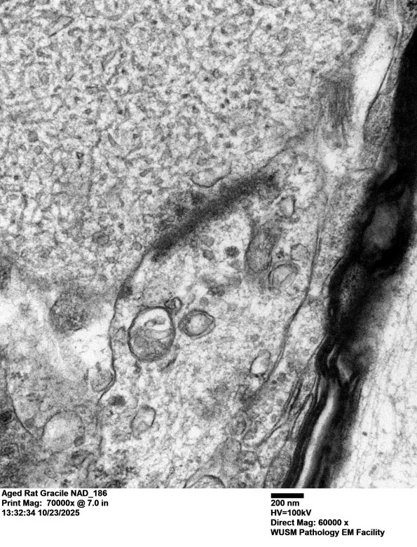 18Q2 Aged Rat Gracile NAD_186 - Copy