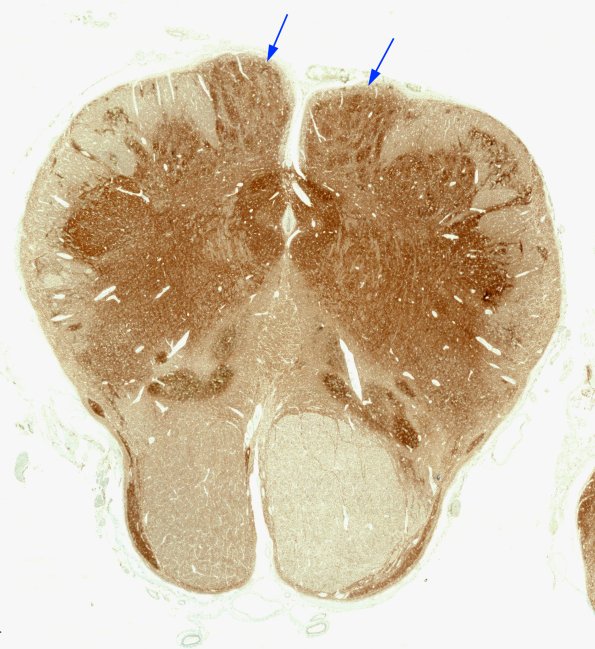 19B1 NAD (Case 27, N8) SYN whole mount 1 copy