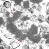 19F5 Neuroaxonal Dystrophy, Gracile (Case 27) EM 012 - Copy copy