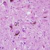 1 Neuromelanin, adult, neurons & macrophages (Case 2) H&E