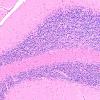 7A Hypoxia-Ischemia Neuronophagia (Case 7) H&E 9