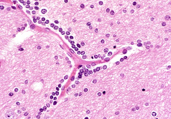 10 Oligodendroglia, satelliting, normal H&E 4