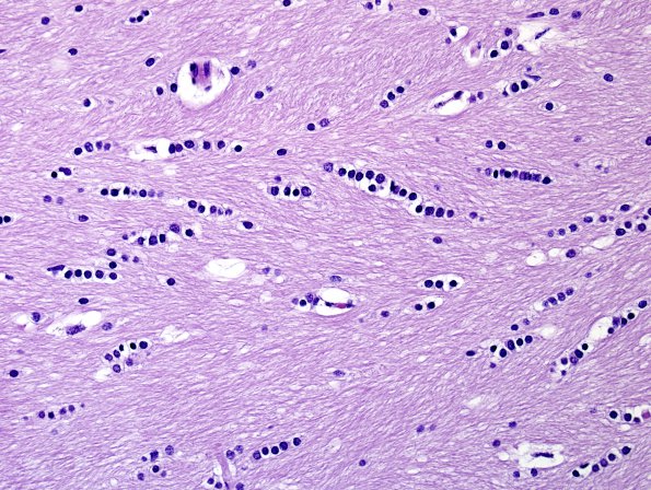 12 Oligodendroglial WM appearance (Speke's gazelle, ZOO) H&E 1