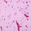 15 Satelliting Oligodendroglia, swan goose (ZOO) H&E 3