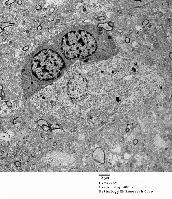 8A1 Oligodendrocyte, satellite neuron, (W15-9844 S15-44926) EM 029 - Copy