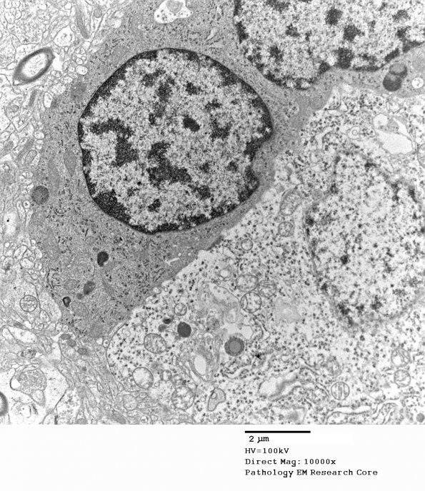 8A2 Oligodendrocyte, satellite neuron, (W15-9844 S15-44926) EM 030 - Copy