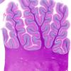 1B1 Superficial Siderosis (Case 1) Cerebellum L side whole mount