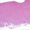 1B Lateral Geniculate Nucleus (LGN) H&E 4X