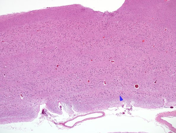 1B Lateral Geniculate Nucleus (LGN) H&E 4X