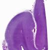 9 Agenesis Corpus Callosum (Case 9) H&E Section V whole mount