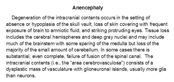 0 Anencephaly Text