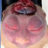 6A3 Exencephaly-Anencephaly (Case 6)_4