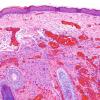 6C1 Exencephaly-Anencephaly (Case 6) N1 H&E 10X