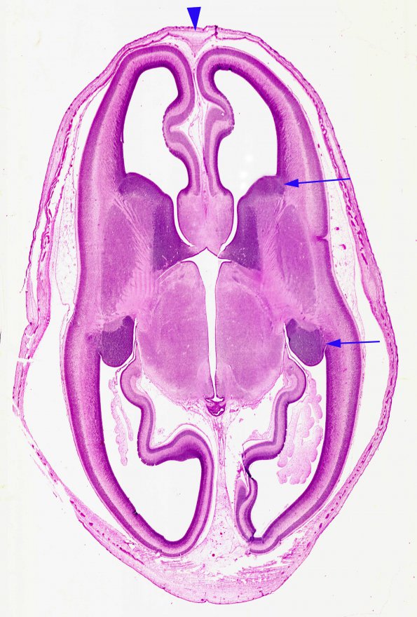 10 Brain, normal, human, 12 wks, horizontal 3