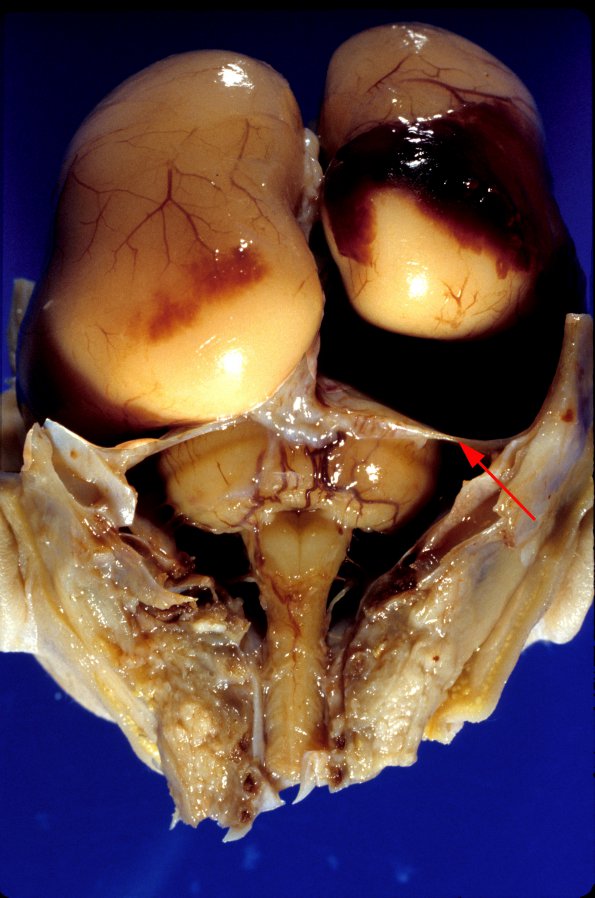 2 Brain, normal, human fetus (24 week) 1