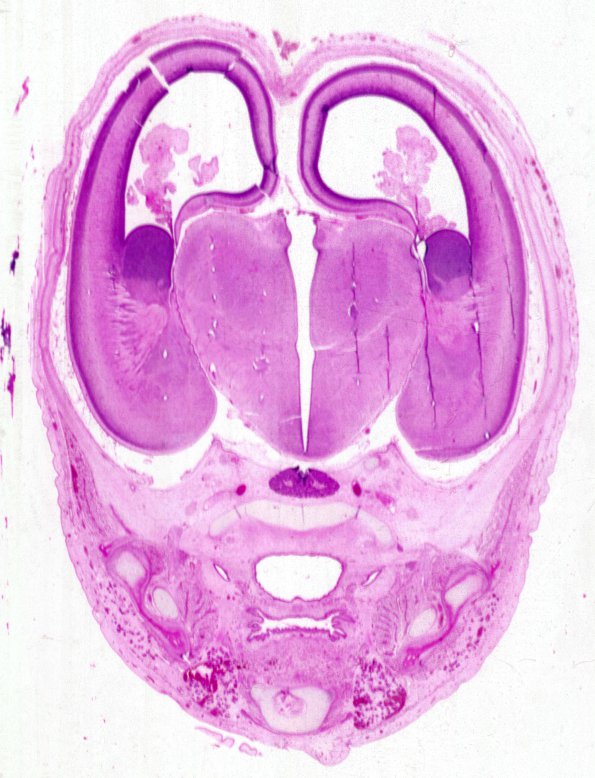 5A2 Brain, normal, human, 12 wk, coronal 2