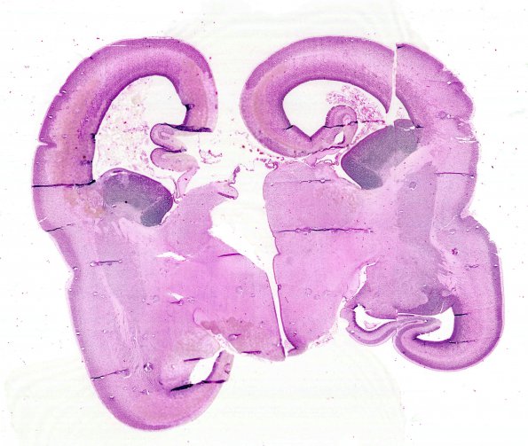 6 Brain, normal, 16 wk, coronal