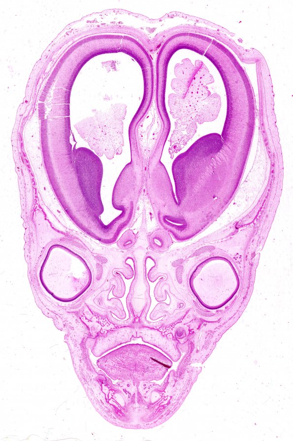 7 Brain, normal, 12 wk, horizontal 4