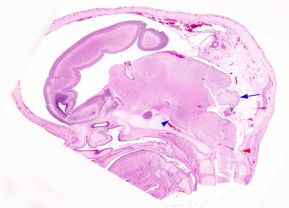 8 Brain, normal 12 wks, sagittal