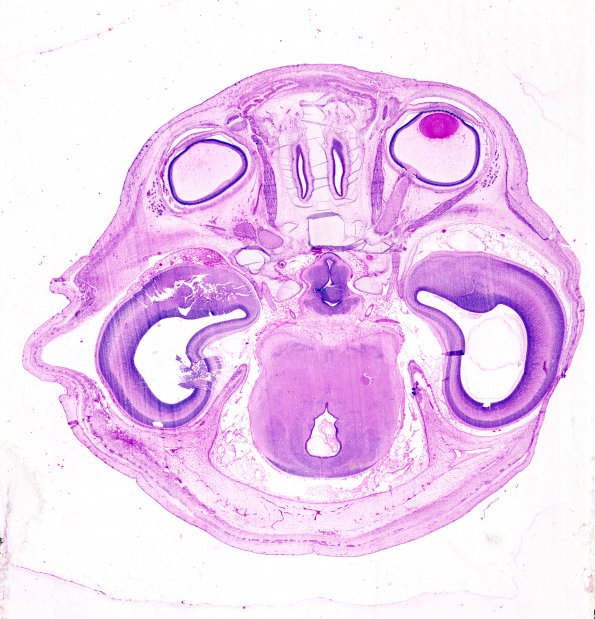 9 Brain, normal, 12 wks, horizontal