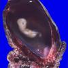 1A Embryo (ectopic pregnancy, approximately 7-8 weeks of gestation) gross 1A