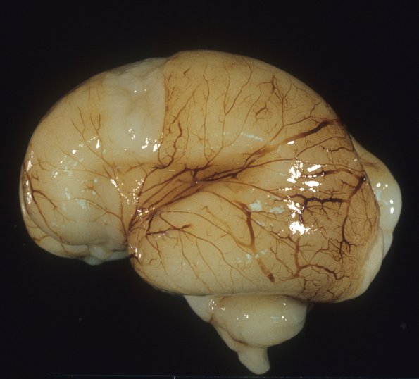 10A1 Normal Fetal Brain 21 wk (Case 10) 1